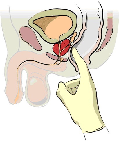 Screening: general concerns